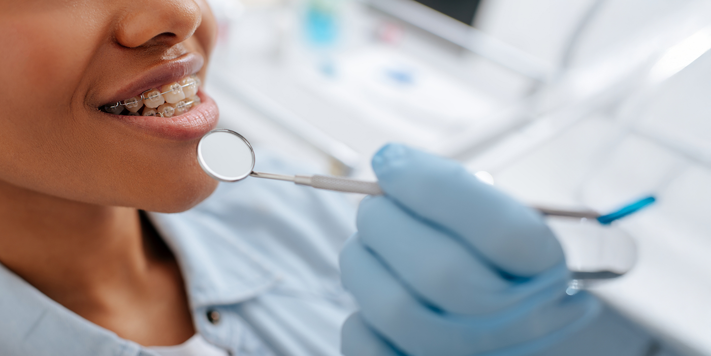 Close up of dental patient with braces